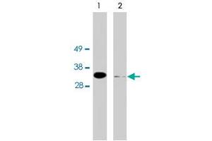Western blot using FHL2 polyclonal antibody on HeLa cell extract (10 ug/lane).