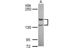 WB Image Sample (30 ug of whole cell lysate) A: Jurkat 5% SDS PAGE antibody diluted at 1:1000