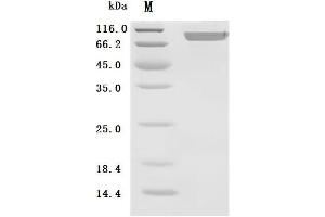 (Tris-Glycine gel) Discontinuous SDS-PAGE (reduced) with 5 % enrichment gel and 15 % separation gel.