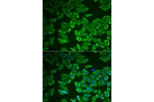 Immunofluorescence analysis of HeLa cell using CRHBP antibody. (CRHBP Antikörper)