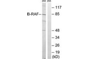 Western blot analysis of extracts from 293 cells, treated with insulin 0. (SNRPE Antikörper  (AA 411-460))