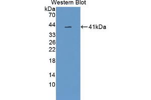 Figure. (GPLD1 Antikörper  (AA 496-840))