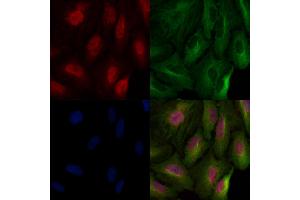 Histone H3 Antibody staining A549 cells by IF/ICC.