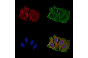 anti-Phorbol-12-Myristate-13-Acetate-Induced Protein 1 (PMAIP1) (N-Term) antibody