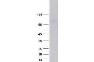 Western Blotting (WB) image for DEAD (Asp-Glu-Ala-Asp) Box Polypeptide 17 (DDX17) (Transcript Variant 1) protein (Myc-DYKDDDDK Tag) (ABIN2719274)