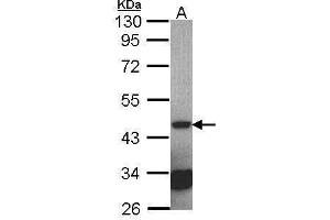 WB Image Sample (30 ug of whole cell lysate) A: NT2D1 10% SDS PAGE antibody diluted at 1:2000 (Septin 2 Antikörper)