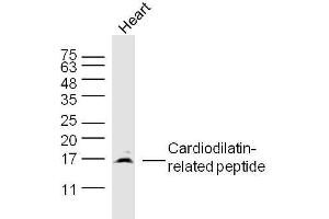 Mouse heart lysates probed with Cardiodilatin-related peptide Polyclonal Antibody, Unconjugated  at 1:300 dilution and 4˚C overnight incubation. (NPPA Antikörper  (AA 26-55))