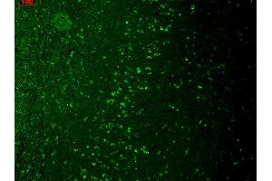 Immunohistochemistry (IHC) image for anti-Transient Receptor Potential Cation Channel, Subfamily M, Member 7 (TRPM7) (AA 1817-1863) antibody (PerCP) (ABIN2483118)