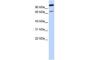 WB Suggested Anti-LST-3TM12 Antibody Titration:  0. (LST-3TM12 Antikörper  (Middle Region))