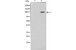 Western blot analysis on HuvEc cell lysate using Nrf2 Antibody,The lane on the left is treated with the antigen-specific peptide.