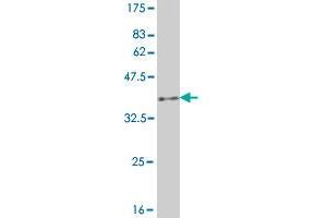 Western Blotting (WB) image for anti-UDP-GlcNAc:BetaGal beta-1,3-N-Acetylglucosaminyltransferase 2 (B3GNT2) (AA 111-210) antibody (ABIN524131)
