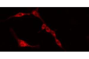 ABIN6274384 staining HeLa cells by IF/ICC. (PFKFB3 Antikörper)