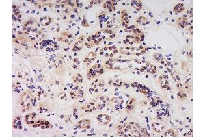 Formalin-fixed and paraffin embedded human kidney labeled with Anti-Caspase-6 (NT) Polyclonal Antibody, Unconjugated  at 1:500 followed by conjugation to the secondary antibody and DAB staining. (Caspase 6 Antikörper  (AA 27-130))