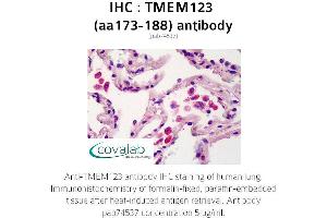 Image no. 1 for anti-Transmembrane Protein 123 (TMEM123) (AA 173-188) antibody (ABIN1740149) (TMEM123 Antikörper  (AA 173-188))