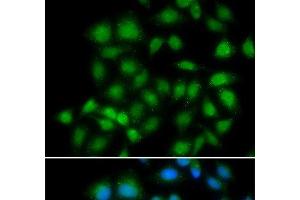 Immunofluorescence analysis of HeLa cells using MXI1 Polyclonal Antibody (MXI1 Antikörper)