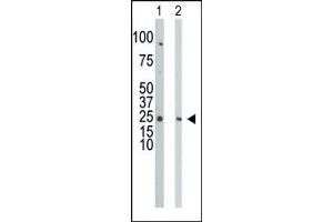 Western Blotting (WB) image for anti-Cytidine Monophosphate (UMP-CMP) Kinase 1, Cytosolic (CMPK1) (C-Term) antibody (ABIN360614) (Cytidine Monophosphate (UMP-CMP) Kinase 1, Cytosolic (CMPK1) (C-Term) Antikörper)