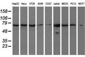 Western blot analysis of extracts (35 µg) from 9 different cell lines by using anti-HAO1 monoclonal antibody. (HAO1 Antikörper)