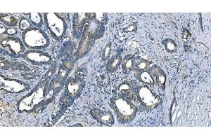 IHC analysis of Carbonic Anhydrase I/CA1 using anti-Carbonic Anhydrase I/CA1 antibody (ABIN7602620).