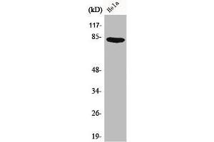 Western Blot analysis of HeLa cells using Catenin-γ Polyclonal Antibody (JUP Antikörper  (C-Term))