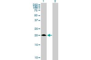 Western Blot analysis of MED30 expression in transfected 293T cell line by MED30 MaxPab polyclonal antibody. (MED30 Antikörper  (AA 1-178))