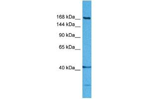 Host:  Rabbit  Target Name:  DISP1  Sample Tissue:  Human MDA-MB-435s Whole Cell  Antibody Dilution:  1ug/ml (DISP1 Antikörper  (Middle Region))