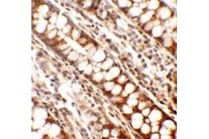 Immunohistochemistry of Periphilin in human colon tissue with Periphilin antibody at 2. (PPHLN1 Antikörper  (Middle Region))