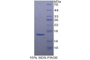 SDS-PAGE (SDS) image for Corticotropin Releasing Hormone (CRH) (AA 28-160) protein (His tag) (ABIN1170244)