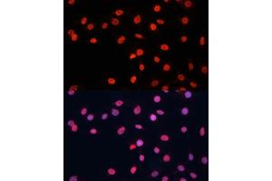 Immunofluorescence analysis of C6 cells using FUS antibody (ABIN6127938, ABIN6140818, ABIN6140819 and ABIN7101788) at dilution of 1:100. (FUS Antikörper  (AA 297-526))