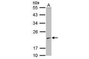 Image no. 1 for anti-S-Phase Kinase-Associated Protein 1 (SKP1) (AA 1-110) antibody (ABIN1500945) (SKP1 Antikörper  (AA 1-110))