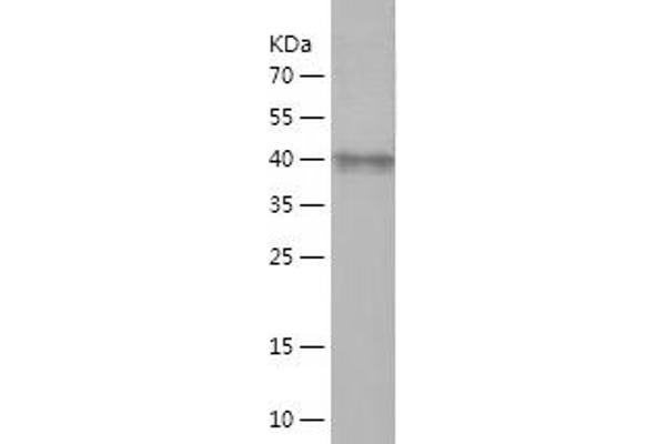 ADAM8 Protein (AA 188-373) (His-IF2DI Tag)