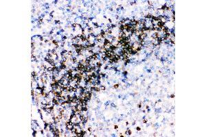Anti- CD79A picoband antibody, IHC(P) IHC(P): Human Tonsil Tissue