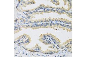 Immunohistochemistry of paraffin-embedded human prostate using CST3 antibody. (CST3 Antikörper  (AA 27-146))