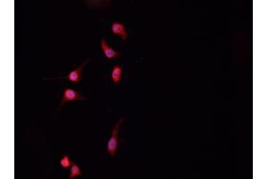 Immunofluorescence (fixed cells) (IF/ICC) image for anti-Baculoviral IAP Repeat-Containing 5 (BIRC5) (pThr117) antibody (ABIN6255588)