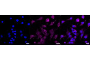 Immunocytochemical staining of HeLa cells with ROR2 antibody (ABIN7800155), 1:1,000). (Rekombinanter ROR2 Antikörper)