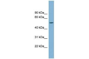 CHST1 antibody used at 1 ug/ml to detect target protein. (CHST1 Antikörper)