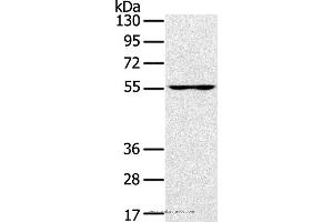 Western blot analysis of PC3 cell, using UBP1 Polyclonal Antibody at dilution of 1:200 (UBP1 Antikörper)