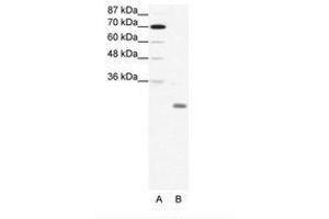 Image no. 1 for anti-Inhibitor of DNA Binding 4, Dominant Negative Helix-Loop-Helix Protein (ID4) (N-Term) antibody (ABIN202035) (ID4 Antikörper  (N-Term))