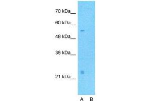 Western Blotting (WB) image for anti-CD40 Ligand (CD40LG) (Middle Region) antibody (ABIN2778145)