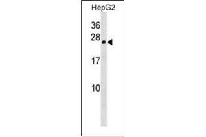 Western blot analysis of Gamma-crystallin B Antibody  in HepG2 cell line lysates (35ug/lane).