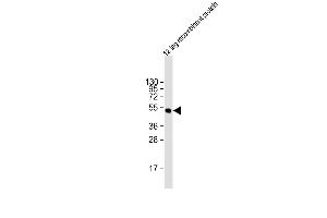Anti-HSV tag Antibody at 1:2000 dilution + 12 tag recombinant protein lysate Lysates/proteins at 20 μg per lane. (HSV Tag Antikörper)