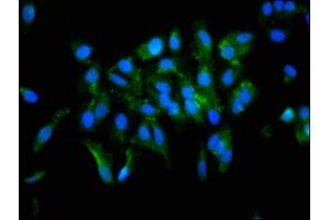 Immunofluorescence staining of Hela cells with ABIN7166409 at 1:133, counter-stained with DAPI. (Transglutaminase 2 Antikörper  (AA 4-544))