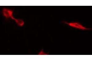ABIN6269121 staining NIH-3T3 by IF/ICC. (c-MET Antikörper  (C-Term))