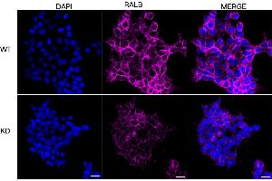 Immunocytochemical staining of HeLa cells using RALB antibody (ABIN7800803), 1:1,000), Top panel: wild-type (WT), Bottom panal: RALB shRNA knockdown (KD).