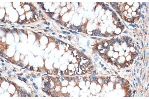Immunohistochemistry of paraffin-embedded Human colon using Aquaporin 4 Polyclonal Antibody at dilution of 1:100 (40x lens). (Aquaporin 4 Antikörper)