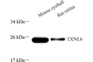 Western blot analysis of TXNL6 (ABIN7074917) at dilution of 1: 500 (NXNL1 Antikörper)