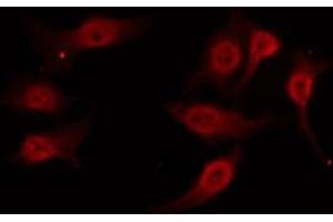 ABIN6277805 staining 293 by IF/ICC. (NCR1 Antikörper  (Internal Region))