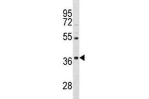 ORAI3 antibody western blot analysis in HepG2 lysate. (ORAI3 Antikörper  (AA 1-30))