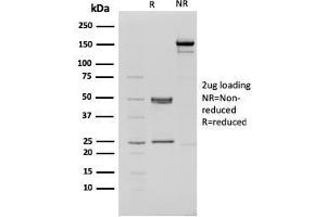 SDS-PAGE (SDS) image for anti-Chromodomain Helicase DNA Binding Protein 4 (CHD4) (C-Term) antibody (ABIN6939119)