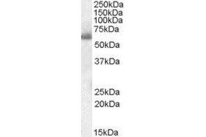 ABIN2559909 (0. (SH2D3A Antikörper  (Internal Region))