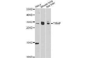 Western blot analysis of extracts of various cell lines, using TIRAP antibody (ABIN6292427) at 1:1000 dilution.